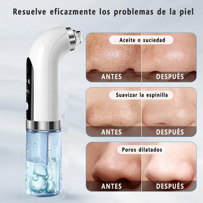 Limpiador de poros - MICRO BUBBLE PRO | Elimina puntos negros y espinillas